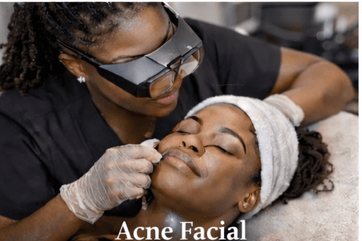 Acne Facial (Grade 1 & 2)