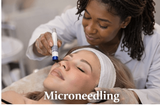 Microneedling